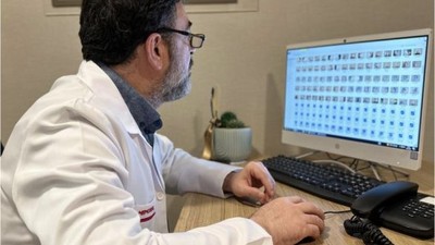 Uzmanlardan 'Deri Kanseri' Uyarısı