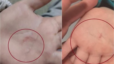 Belediyeye Bağlı Kreşte Şiddet İddiaları