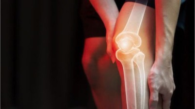 Bu Hastalık Çok Sık Görülüyor! İşte Bilmeniz Gerekenler