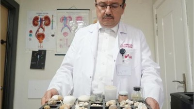 22 Yıldır Ameliyatla Aldığı Böbrek Taşlarını Biriktiriyor