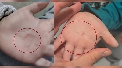 Bandırma Gündüz Bakımevi'nde Şiddet Skandalı