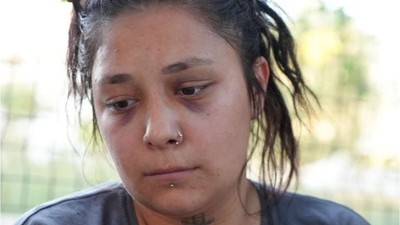 Balıkesir'de Tedavi İçin Gitti 'Ölü' Olduğunu Öğrendi!