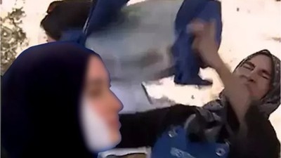 MasterChef'te Yüzü Yandı! İşte Yarışmacının Son Durumu