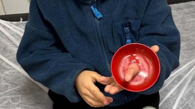 Parmağına Zil Çanı Sıkışan Çocuğu İtfaiye Kurtardı