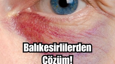Gözaltı Morluklarına Balıkesirli Kadınların Sırrı
