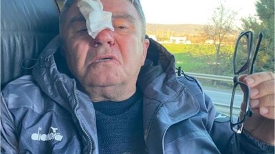Taşlı Saldırıda Sportif Direktör Yaralandı