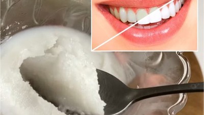 15 Dakikada Doğal Diş Beyazlatma Yöntemi