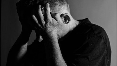 Depresyon Nedir? Tedavisi Nasıl Olur?