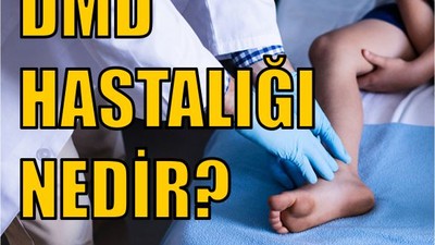 DMD Kas Hastalığı Nedir?