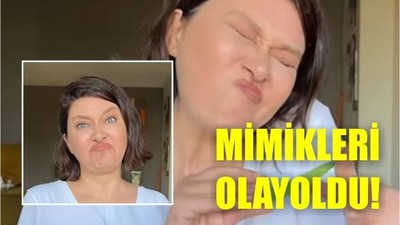 Akıma Nurgül Yeşilçay da Katıldı! Yüzü Şekilden Şekile Girdi