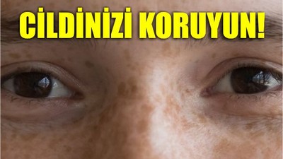 Güneş Lekelerini 5 Adımda Önleyin