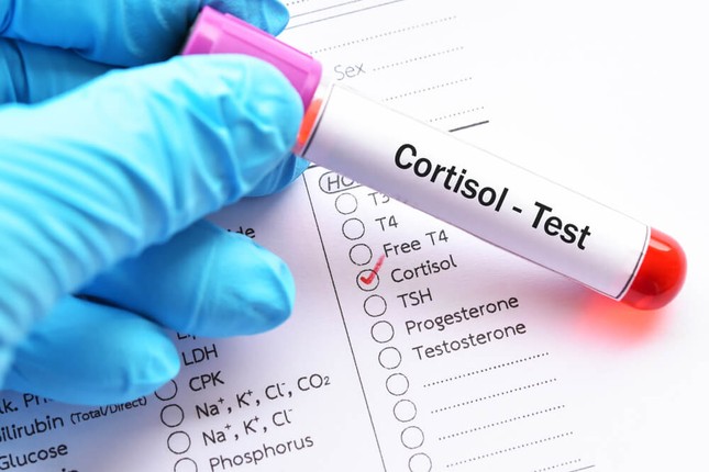 Stres Hormonu Nasıl Çalışır? 