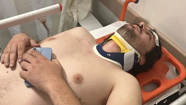 Ünlü Oyuncu Öldüresiye Darp Edildi!