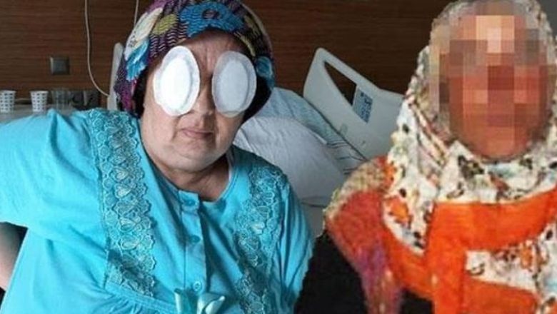 Şizofreni Hastasından Dehşet Saldırı: Gözlerini Oydu!