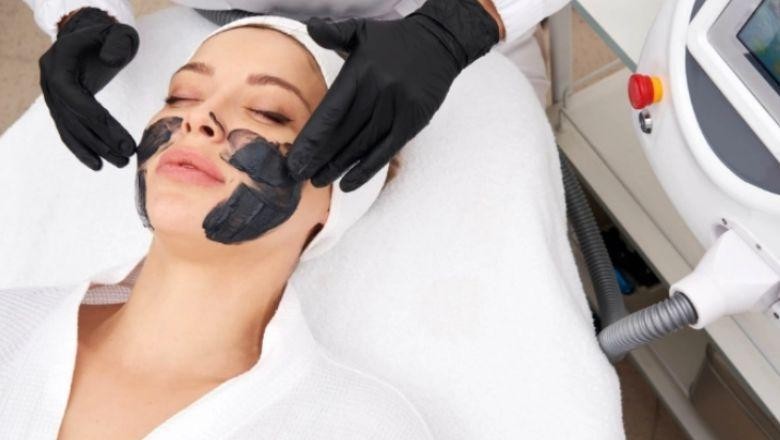 Karbon Peeling Nedir?