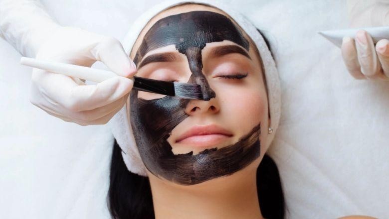 Karbon Peeling Nedir?