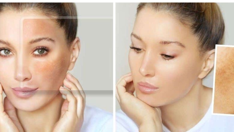 Cilt Bakımında Retinol