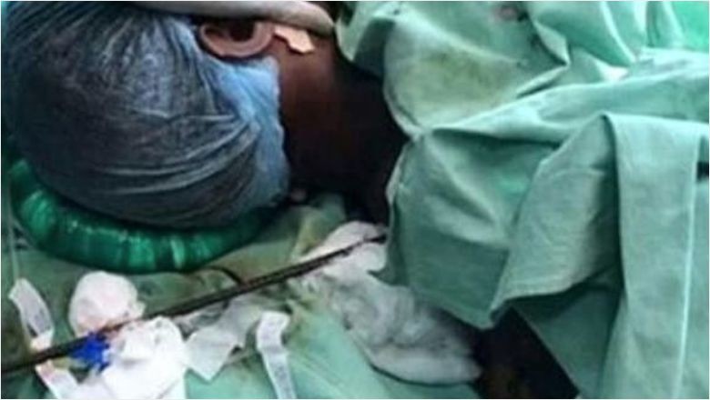 İnşaat İşçisi Sivri Demirlerin Üzerine Düştü