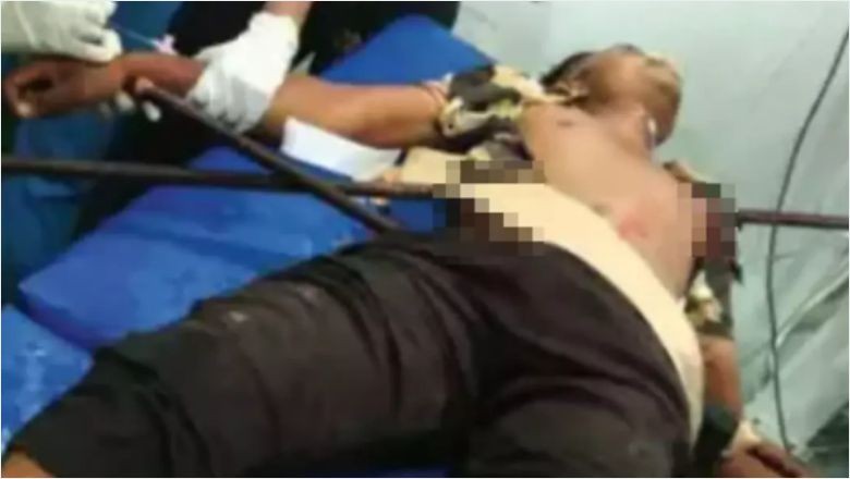 İnşaat İşçisi Sivri Demirlerin Üzerine Düştü