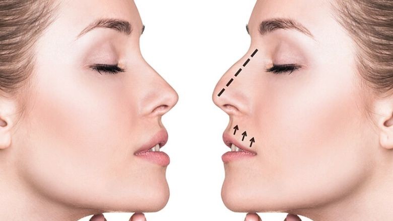 Burun Şeklinize Uygun 6 Saç Modeli