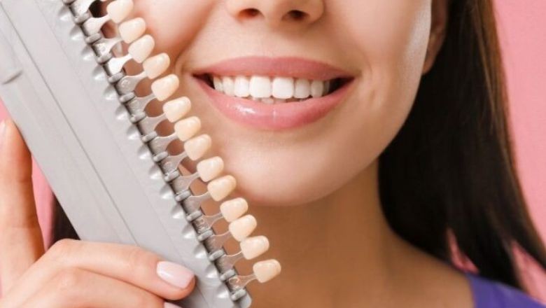 Gülüş Estetiği Nedir?