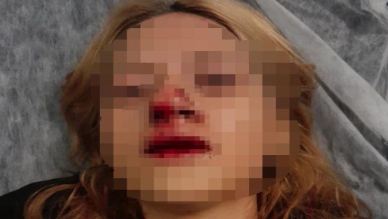 Kaldırım Taşıyla Genç Kız Saldırdılar!