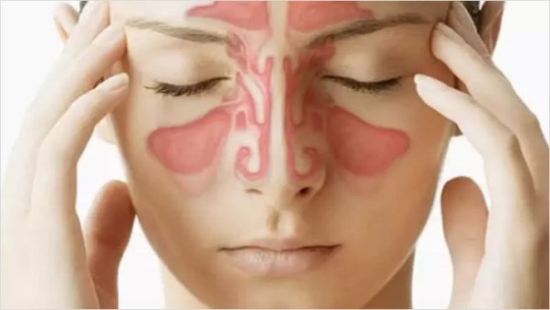 Sinüzit Nedir? Sinüzite Ne İyi Gelir ve Belirtileri Nelerdir?