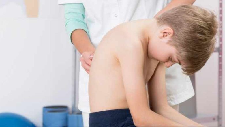 Çocuklarda Skolyoz Teşhisi Ailelerin Görevi