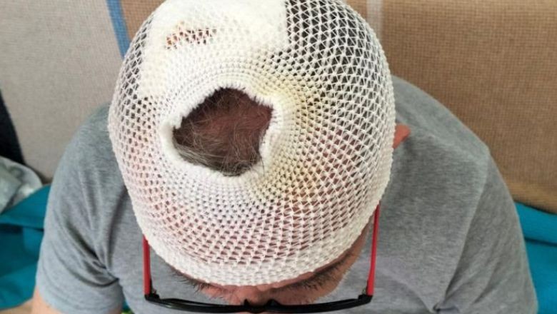 Balıkesir’de Öğretmene Cop’lu Saldırı!