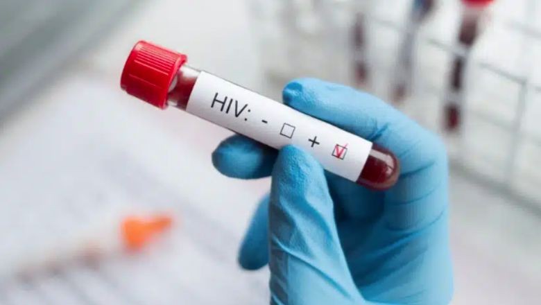 HIV Tedavisinde Çığır Açan Adım