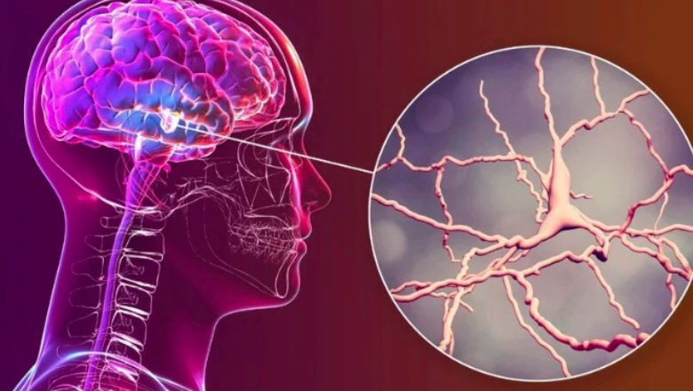 Parkinson Teşhisi İçin Yeni Yöntem Geliştirildi
