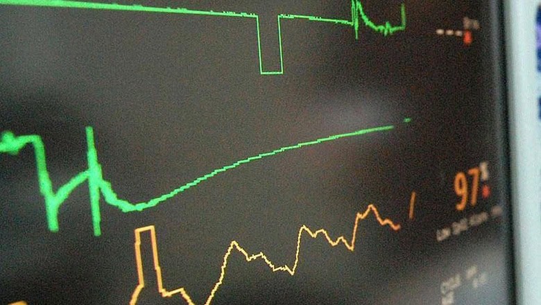 Brugada sendromu Brugada sendromu