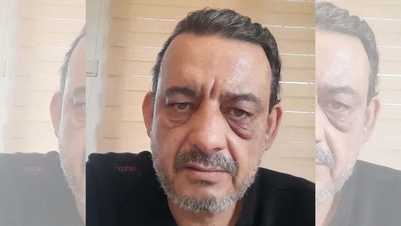 Gazeteciyi Darp Eden Saldırgan Tutuklandı