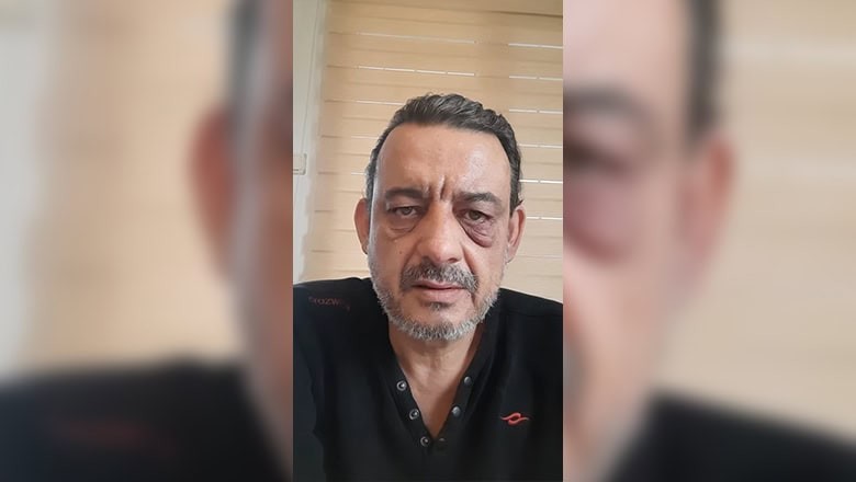 BURHANİYE’Lİ GAZETECİ SALDIRIYA UĞRADI BURHANİYE’Lİ GAZETECİ SALDIRIYA UĞRADI