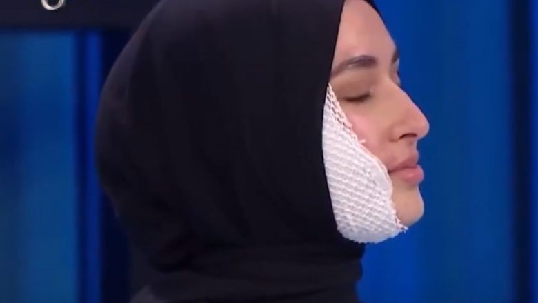 MasterChef'te Yüzü Yandı! İşte Yarışmacının Son Durumu