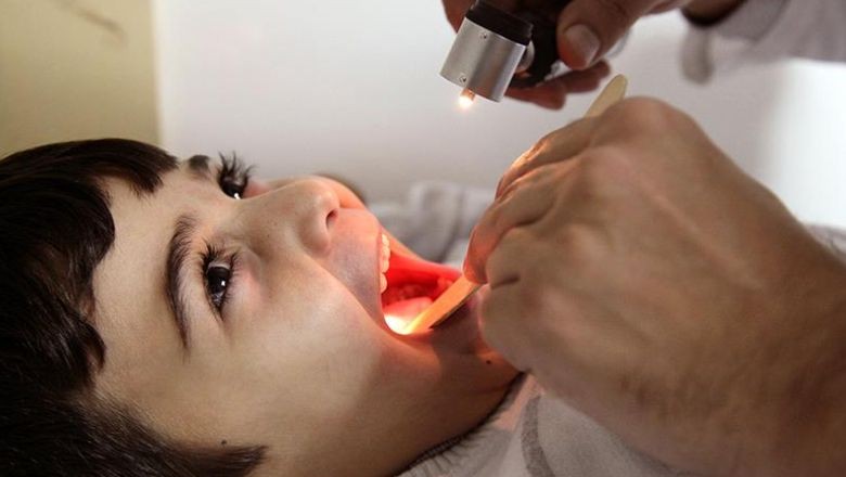 Geçmeyen Öksürük Hangi Hastalıkların Belirtisi?