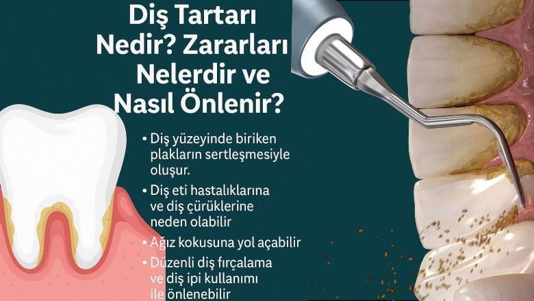 Diş Tartarı (Diş Taşı) Nedir? Zararları Nelerdir ve Nasıl Önlenir?
