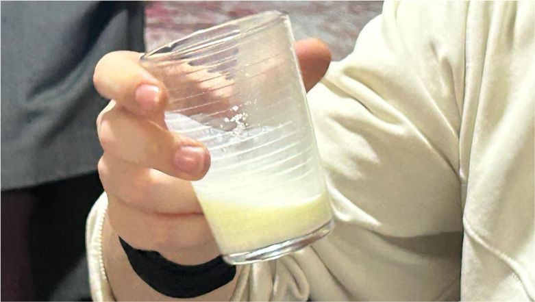 Keçi Sütü Ağız: Doğanın Şifa Dolu İlk Sütü