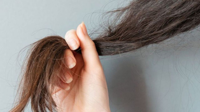 Yazın Kabaran Saçlara Balıkesirlilerden Çözüm