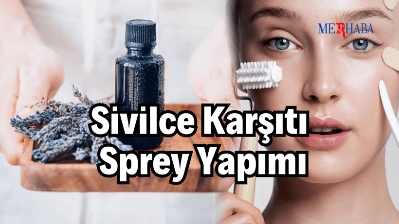 Sivilce Karşıtı Sprey Yapımı