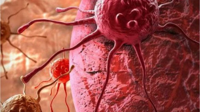 Kanser Hücrelerine Duvar Ören O Besin...