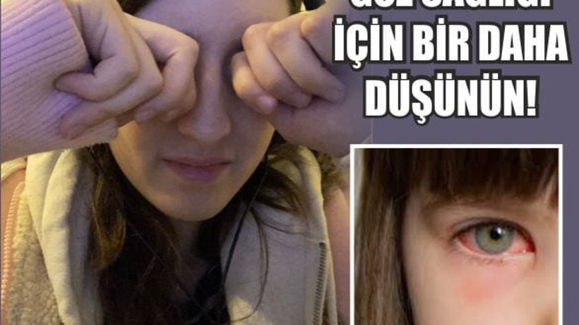 Gözlerimizi Ovalayınca Neden Bulanık Görürüz?