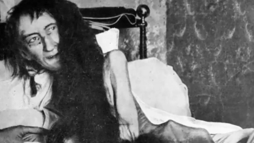 25 Yıl Karanlıkta Tutulan Kadın: Blanche Monnier’in Gerçek Hikayesi - Resim: 3