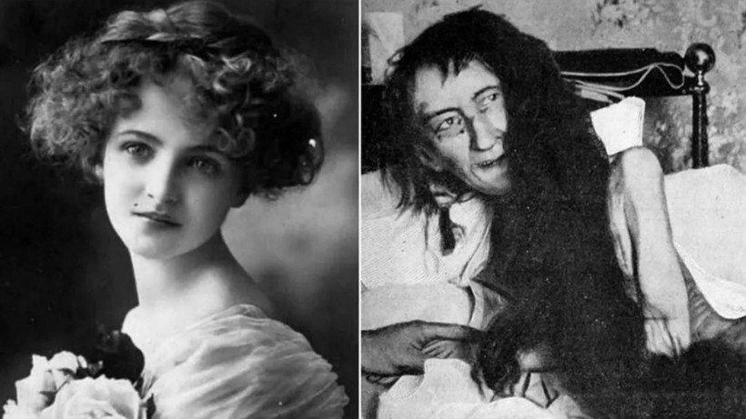 25 Yıl Karanlıkta Tutulan Kadın: Blanche Monnier’in Gerçek Hikayesi - Resim: 7