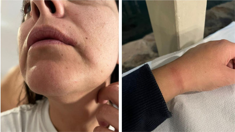 Midilli’de Türk Çifte Şok Muamele: Kabusu Gibi Saatler!