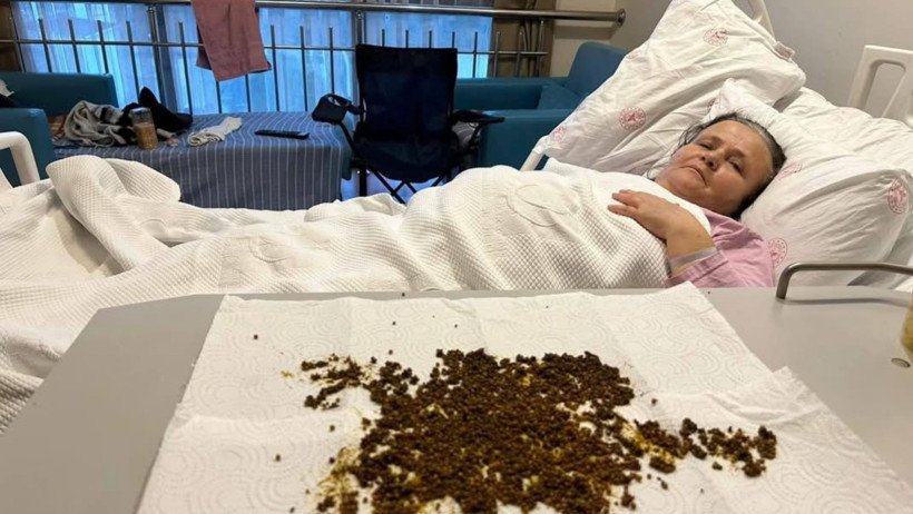 Soma’da 70 Yaşındaki Kadının Safra Kesesinden 20 Bin Taş Çıkarıldı