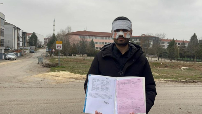 Okulda Şok Olay! Bir Öğretmen Diğerine Kaynar Çay mı Fırlattı?