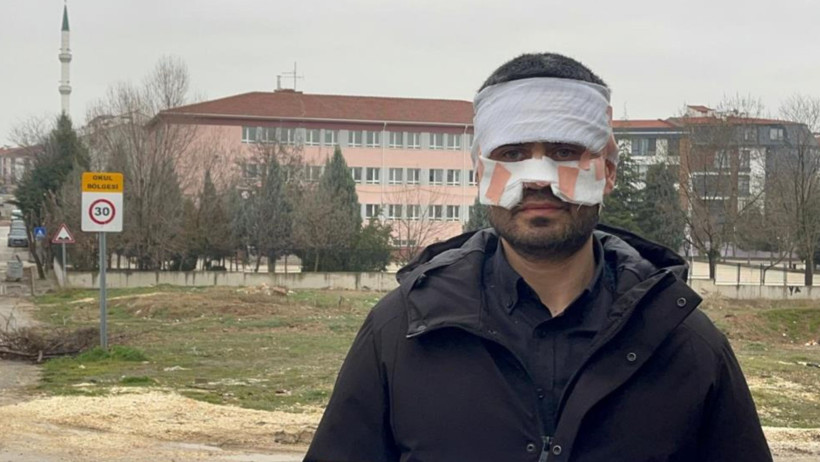 Okulda Şok Olay! Bir Öğretmen Diğerine Kaynar Çay mı Fırlattı?