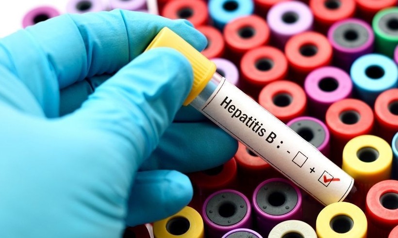Hepatit B'de 1998'den önce doğanlar daha büyük risk altında"