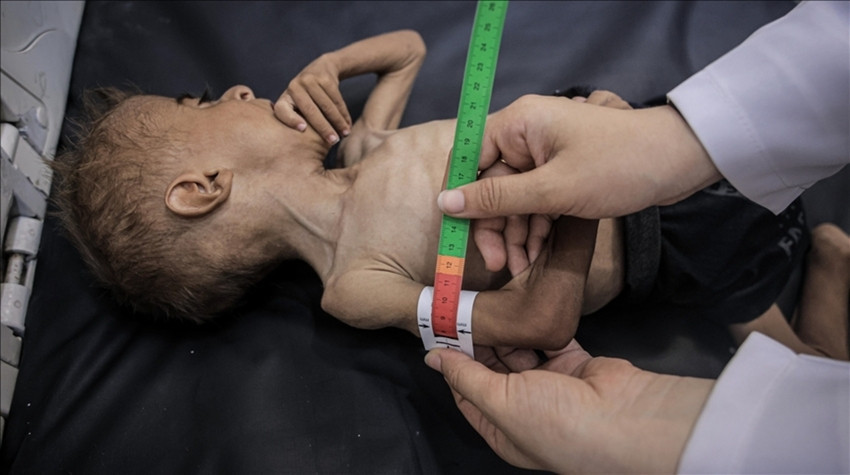 İsrail’in Gazze Saldırılarında 25 Filistinli Hayatını Kaybetti